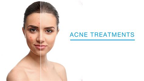 Acne Treatment At Laser Skin Institute Chatam Nj