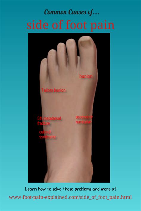 Foot Problems Artofit