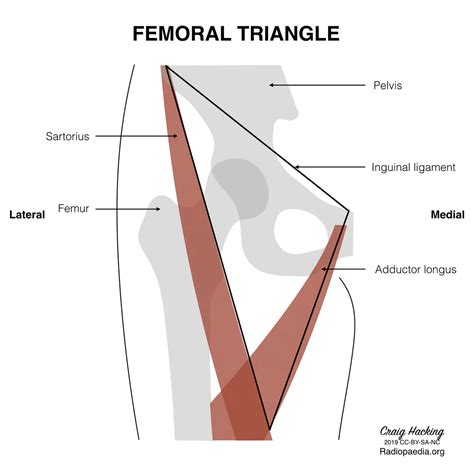 Femoral Triangle Diagram Radiology Case
