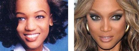 Tyra Banks Before And After Plastic Surgery 22 Celebrity Plastic