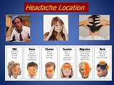 Bad Migraine Treatment Photos