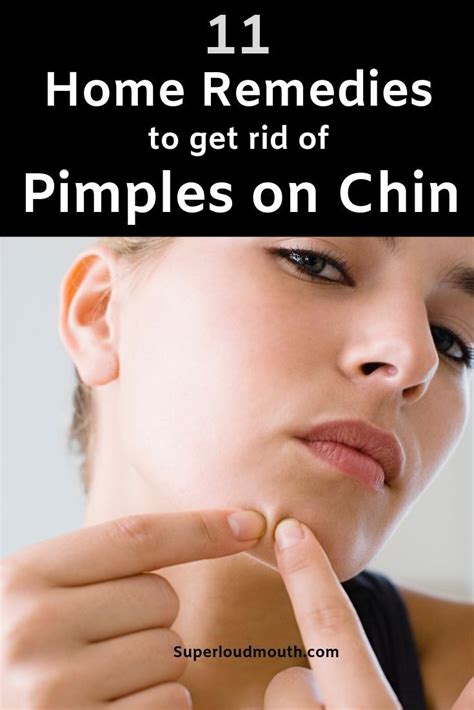 Pimples On Chin Meaning How To Get Rid Of Break Out On Chin Artofit