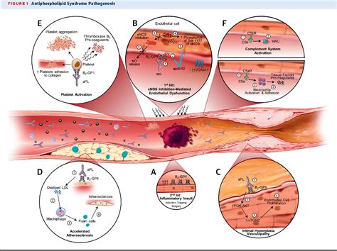 Figure 1 From Antiphospholipid Syndrome Role Of Vascular Endothelial