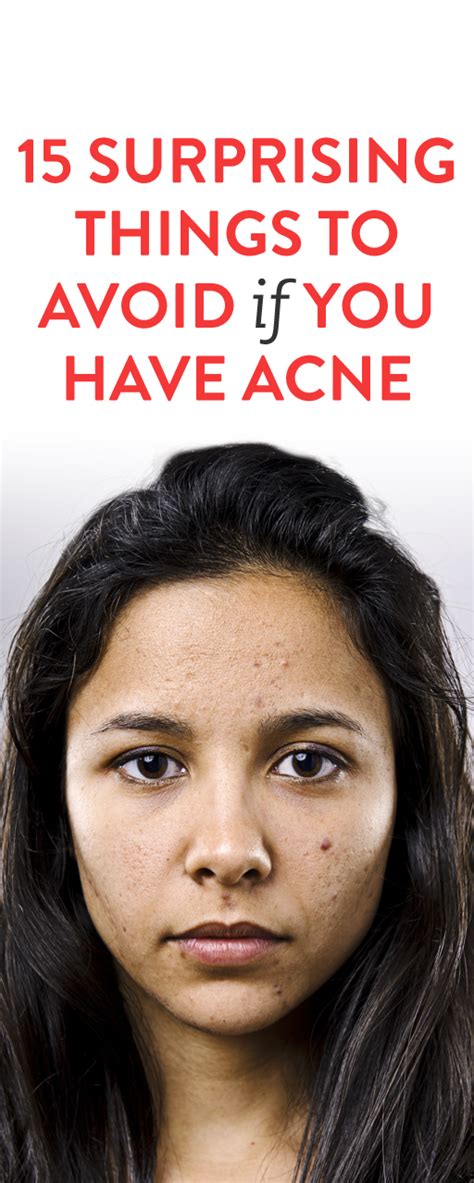 15 Surprising Things To Avoid If You Have Acne Face Care Acne Skin