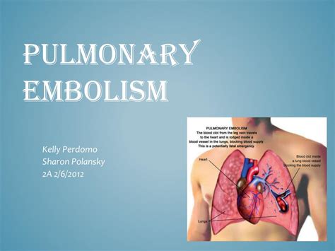 Ppt Pulmonary Embolism Powerpoint Presentation Free Download Id 2807788