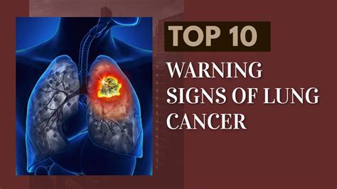 10 Warning Signs Of Lung Cancer Youtube