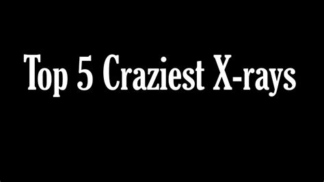 Craziest X Rays You Won T Believe Are Real Youtube