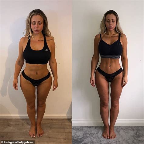 Holly Hagan Says Cosmetic Surgery Made Her Look Awful And Vows To