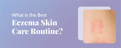 What Is The Best Eczema Skin Care Routine