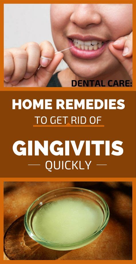 Home Remedies To Get Rid Of Gingivitis Quickly In 2020 Gum Disease