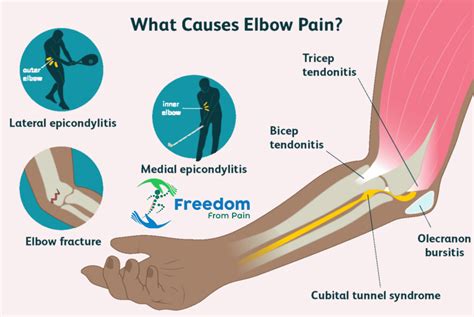 Elbow Pain Treatment In Hyderabad Elbow Joint Pain Specialist Doctors