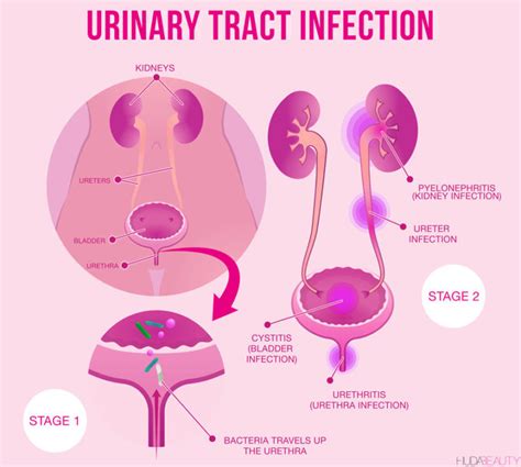Why Youre Getting Utis And How To Avoid Them Blog Huda Beauty