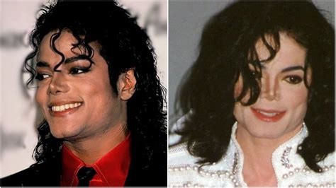 Did Michael Jackson Bleach His Skin Stars Skin Condition Explored