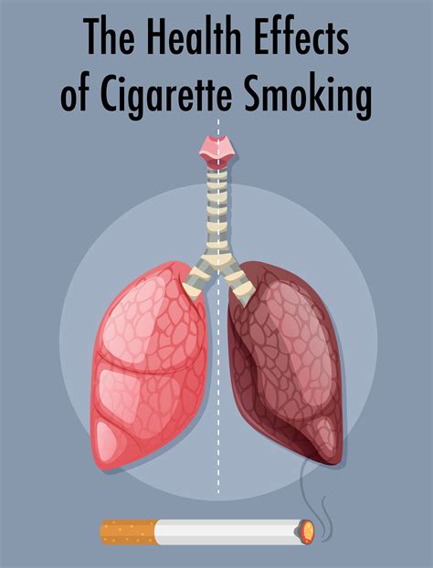 Poster On Health Effects Of Cigarette Smoking 1848879 Vector Art At Vecteezy