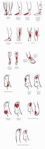 Trigger Point Referral Patterns For The Ankle Foot Weight