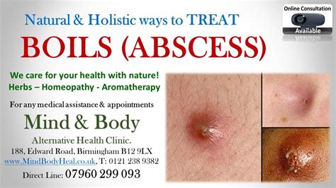 Boils Abscess Etc Mind And Body Holistic Health Clinic