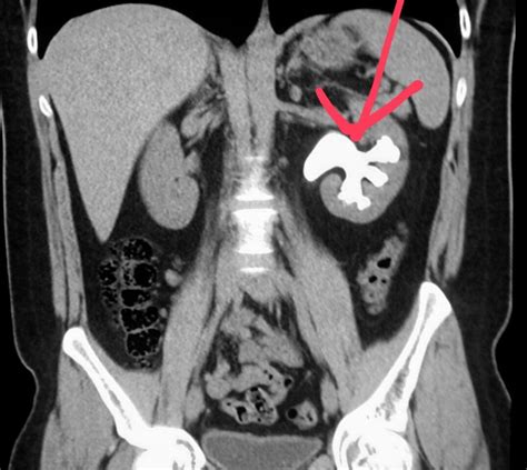 Pin On Ct Scans