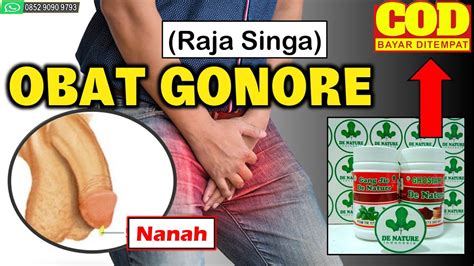 Gejala sifilis diawali dengan munculnya luka yang tidak terasa sakit di area kelamin, mulut, atau dubur. OBAT GONORE (Raja Singa) Bayar Di Tempat - COD - YouTube