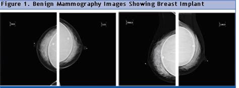 Rad Tech Ce Asrt Arrt® Ce Category A Credits Radiology Continuing