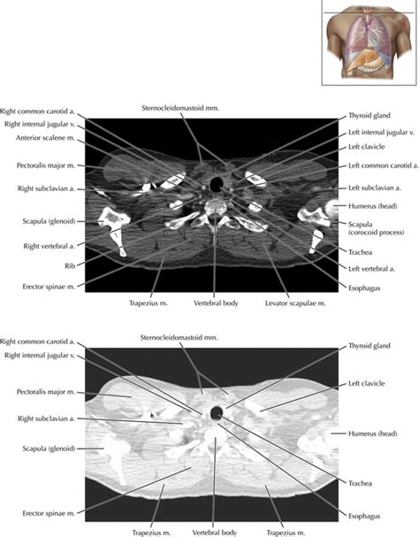 Thoracic Soft Tissue And Lung Radiology Key