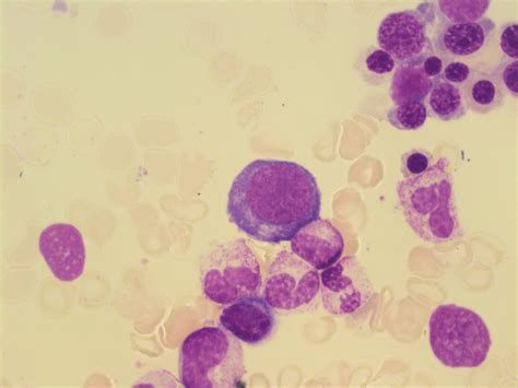 Red Blood Cell Maturation A Laboratory Guide To Clinical Hematology