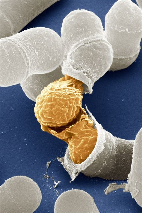 Yeast Cell Under Electron Microscope Micropedia