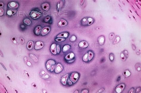 Photograph Hyaline Cartilage Lm Science Source Images