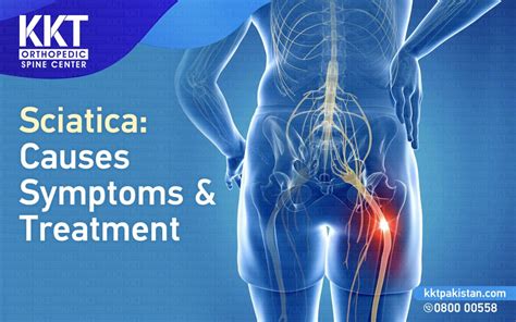 Sciatica Treatment Symptoms And Causes