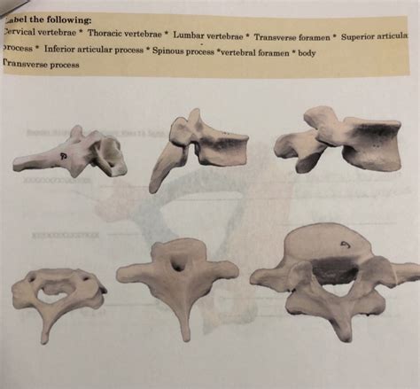 Solved Label The Following Cervical Vertebrae Thoracic Chegg Com