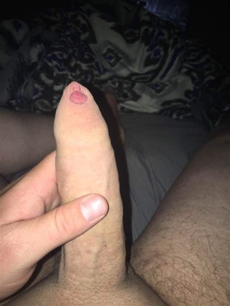 uncircumcised cock xnxx adult forum