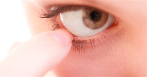 Ingrown Eyelash Causes And How To Treat It