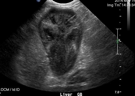 Ultrasonographic Features Of Gall Bladder Mucocele In Dogs When To