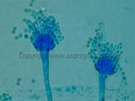 A Fumigatus Archives Page 10 Of 10 Aspergillus And Aspergillosis