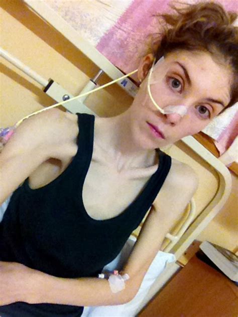 Former Anorexic Is Now A Gym Bunny And Is On A Mission To Help Others