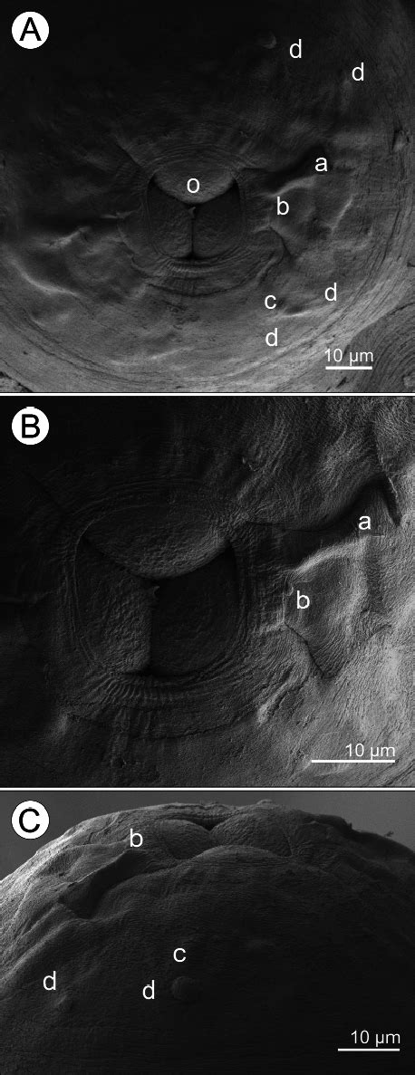 Philometra Spiriformis Sp N Scanning Electron Micrographs Of Gravid