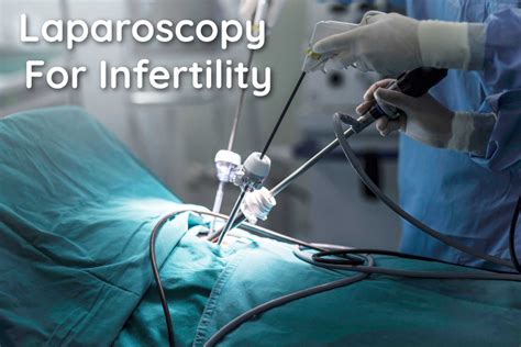 Laparoscopy For Infertility Treatment Does It Help In Getting