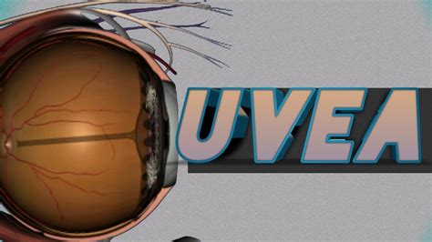 Uvea Of Eye Anatomy Of Uvea Youtube