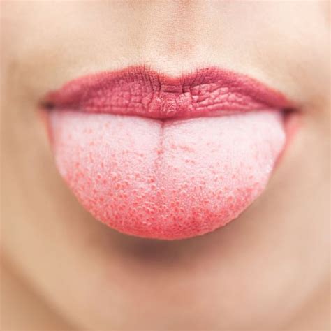 All The Possible Reasons Your Taste Buds Might Be Swollen According To