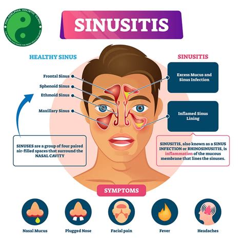 Treatment For Sinus Infection Philadelphia Homeopathic Clinic Dr Tsan