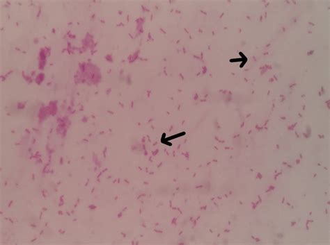 Direct Gram Stain From Blood Culture Bottle Showing Gram Negative