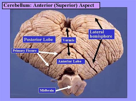 Gross Anatomy Of The Brain Dr G R