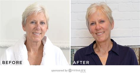 72 year old reveals her all natural anti aging secret