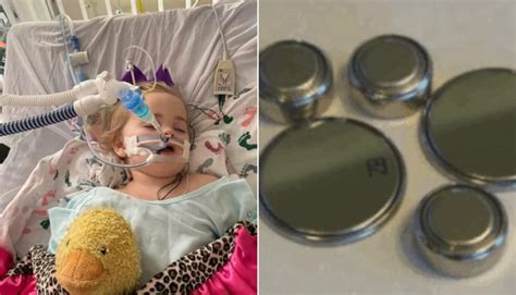 One Year Old Girl Dies After Swallowing Battery That Generated Electricity Inside Her Photos
