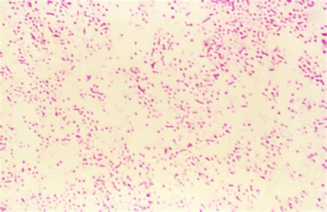Public Domain Picture This Gram Stained Micrograph Revealed Coccoid