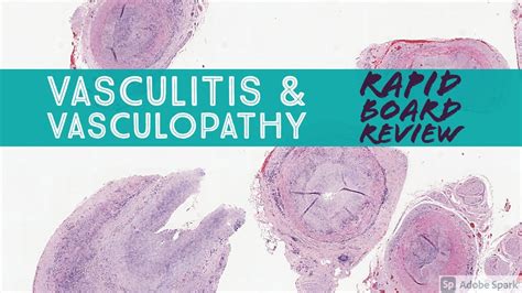 Dermpath Board Review Vasculitis And Vasculopathy Dermpath Dermatology