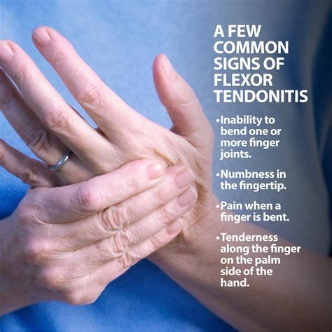 Flexor Tendonitis Florida Orthopaedic Institute