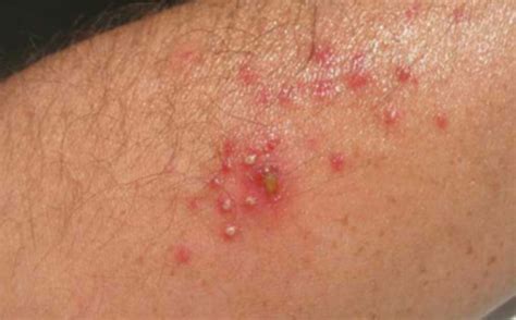 Skin Conditions With Symptoms Causes And Treatment Tibot