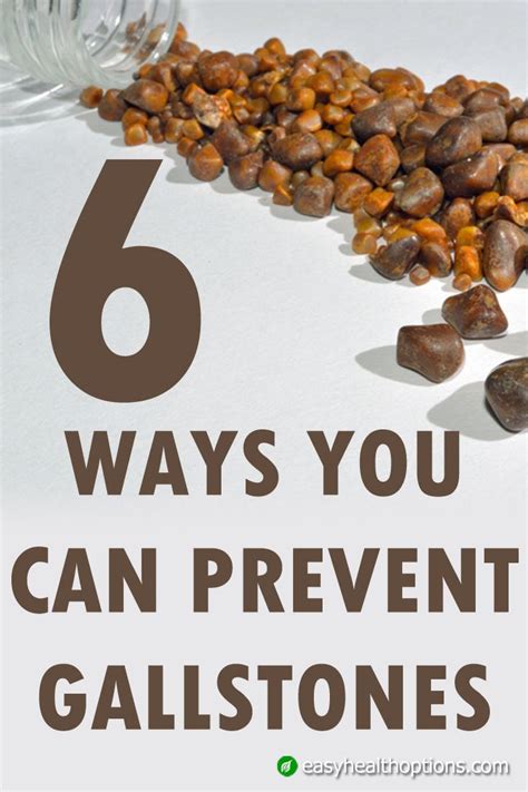 Easy Health Options® 6 Ways You Can Prevent Gallstones Gallstones