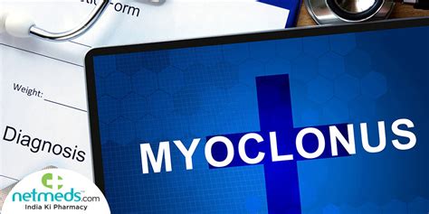 Myoclonus Causes Symptoms And Treatment