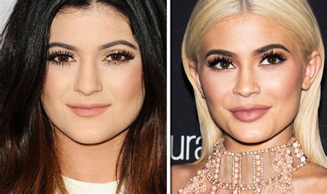 kylie jenner plastic surgery before and after life life and style uk
